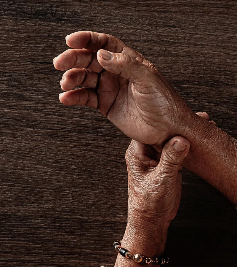 Arthritis