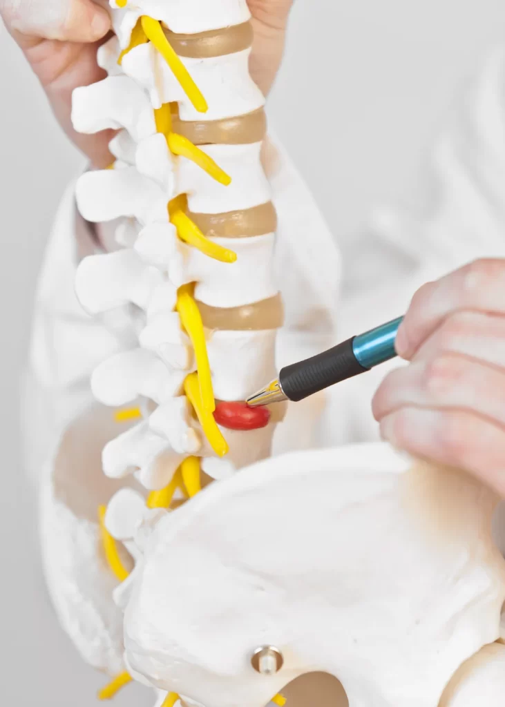 Care for Disc Injuries img 1