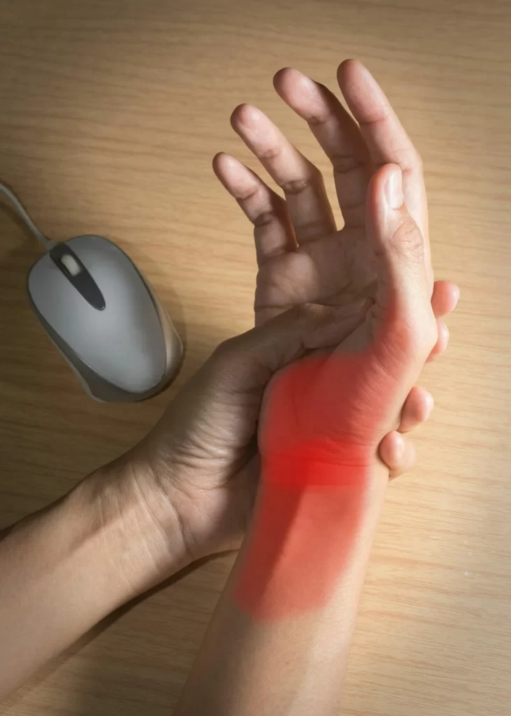 Carpal Tunnel image